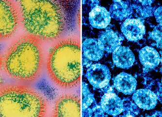 ▲ 독감 바이러스(왼쪽)와 코로나 바이러스 모습